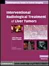 Interventional Radiological Treatment of Liver Tumors (eBook)